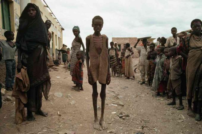 Victimes de la famine résultant de la guerre civile en Somalie.